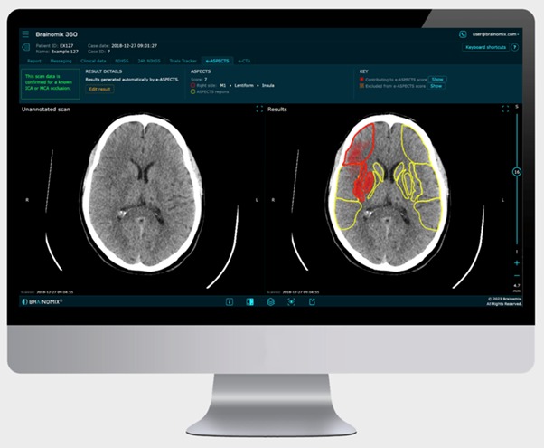 AI Medical Imaging Tool